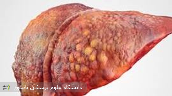 آیا-می-توان-با-غذا،-چربی-کبد-را-کاهش-داد؟